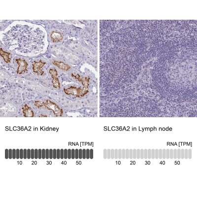 Immunohistochemistry-Paraffin: SLC36A2 Antibody [NBP2-49360]