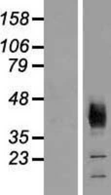 Western Blot: SLC36A2 Overexpression Lysate [NBP2-04892]