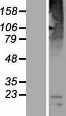 Western Blot: SLC36A3 Overexpression Lysate [NBP2-04891]