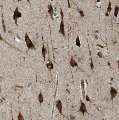 Immunohistochemistry-Paraffin: SLC36A4 Antibody [NBP1-81931]