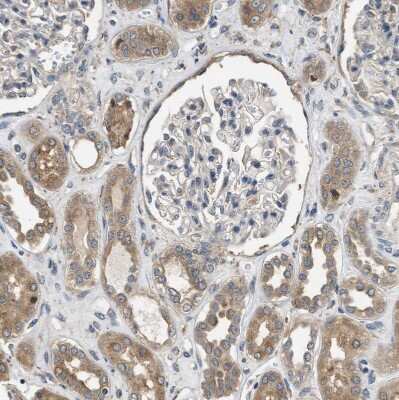Immunohistochemistry-Paraffin: SLC36A4 Antibody [NBP1-81931]