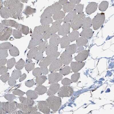 Immunohistochemistry-Paraffin: SLC36A4 Antibody [NBP1-81931]