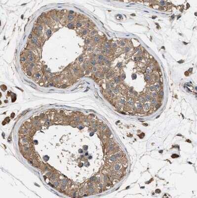 Immunohistochemistry-Paraffin: SLC36A4 Antibody [NBP1-81931]
