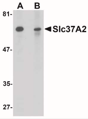 Western Blot: SLC37A2 AntibodyBSA Free [NBP1-77132]