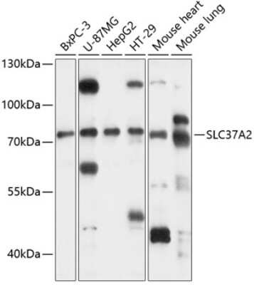 Western Blot: SLC37A2 AntibodyAzide and BSA Free [NBP2-94345]