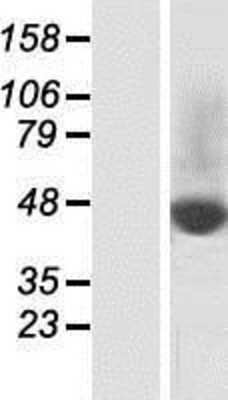 Western Blot: SLC37A2 Overexpression Lysate [NBP2-04718]