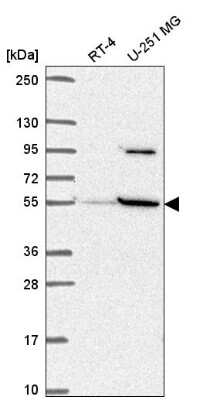 Western Blot: SLC37A3 Antibody [NBP2-57417]