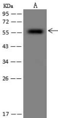 Western Blot: SLC37A3 Antibody [NBP3-12693]