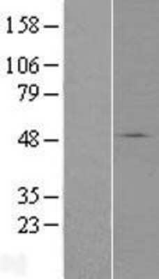 Western Blot: SLC37A3 Overexpression Lysate [NBP2-06051]