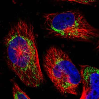 Immunocytochemistry/ Immunofluorescence: SLC37A4 Antibody [NBP2-31972]