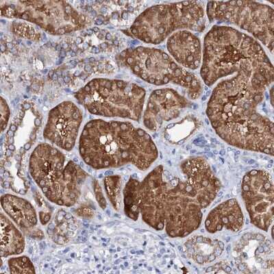 Immunohistochemistry-Paraffin: SLC37A4 Antibody [NBP2-31972]