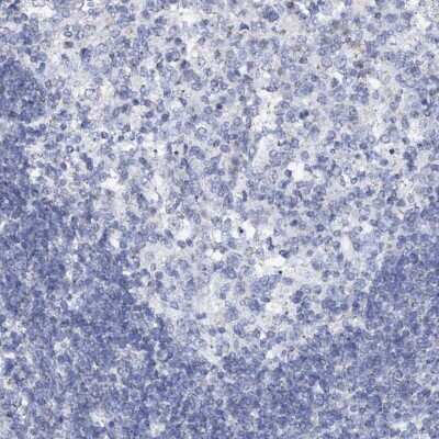 Immunohistochemistry-Paraffin: SLC37A4 Antibody [NBP2-31972]