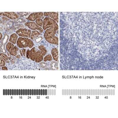 Immunohistochemistry-Paraffin: SLC37A4 Antibody [NBP2-31972]
