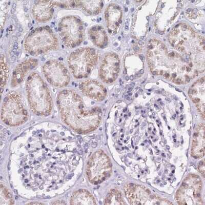 Immunohistochemistry-Paraffin: SLC37A4 Antibody [NBP2-31973]