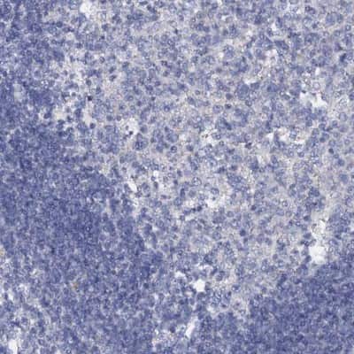 Immunohistochemistry-Paraffin: SLC37A4 Antibody [NBP2-31973]