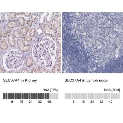 Immunohistochemistry-Paraffin: SLC37A4 Antibody [NBP2-31973]