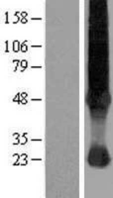 Western Blot: SLC37A4 Overexpression Lysate [NBP2-10199]