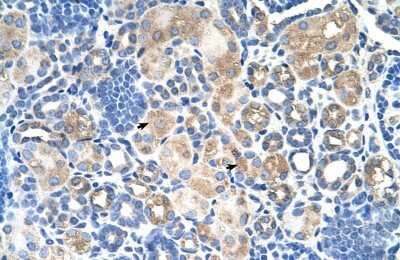 Immunohistochemistry-Paraffin: SLC38A1 Antibody [NBP1-59650]