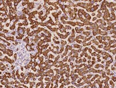 Immunohistochemistry-Paraffin: SLC38A1 Antibody [NBP3-06520]