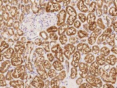 Immunohistochemistry-Paraffin: SLC38A1 Antibody [NBP3-06520]