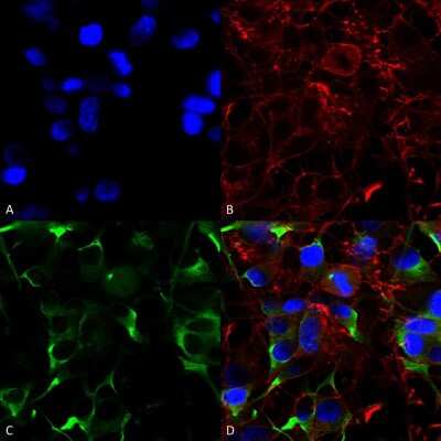 Immunocytochemistry/ Immunofluorescence: SLC38A1 Antibody (S104-32) [NBP2-59311]