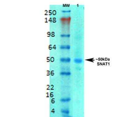 Western Blot: SLC38A1 Antibody (S104-32) [NBP2-59311]
