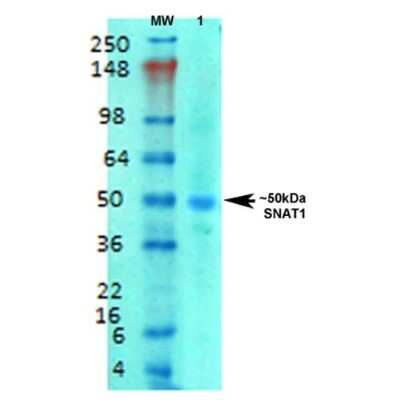 Western Blot: SLC38A1 Antibody (S104-32) [NBP2-59311]