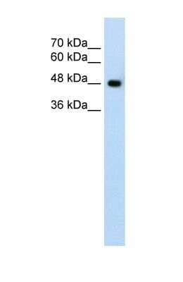 Western Blot: SLC38A1 Antibody [NBP1-59649]