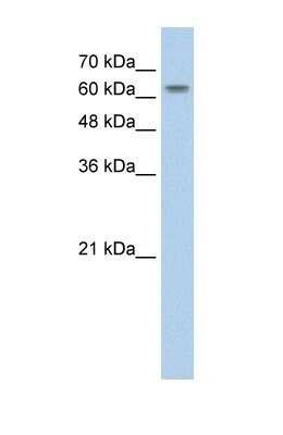 Western Blot: SLC38A1 Antibody [NBP1-59650]