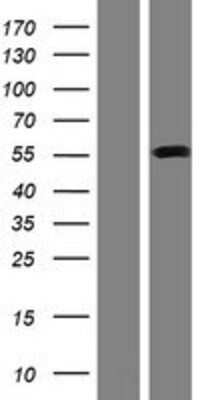 Western Blot: SLC38A1 Overexpression Lysate [NBP2-08459]