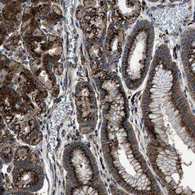 Immunohistochemistry: SLC38A10 Antibody [NBP1-81195]