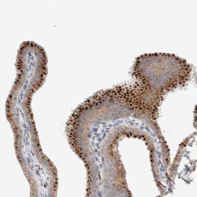 Immunohistochemistry-Paraffin: SLC38A10 Antibody [NBP1-81193]