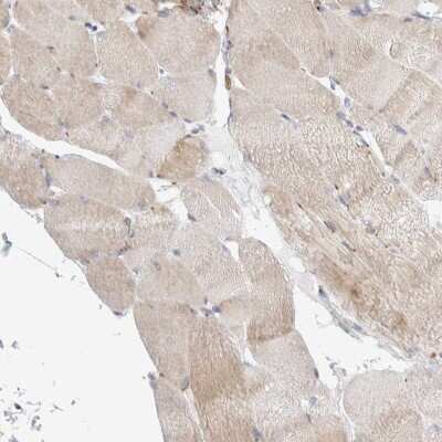 Immunohistochemistry-Paraffin: SLC38A10 Antibody [NBP1-81193]