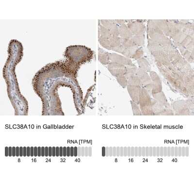 Immunohistochemistry-Paraffin: SLC38A10 Antibody [NBP1-81193]