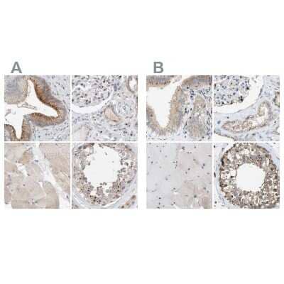 Immunohistochemistry-Paraffin: SLC38A10 Antibody [NBP1-81193]