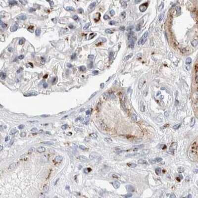 Immunohistochemistry-Paraffin: SLC38A10 Antibody [NBP1-81193]