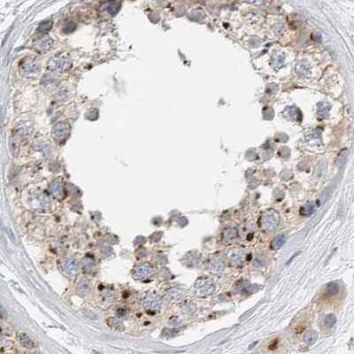 Immunohistochemistry-Paraffin: SLC38A10 Antibody [NBP1-81193]