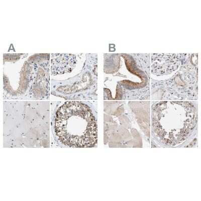 Immunohistochemistry-Paraffin: SLC38A10 Antibody [NBP1-81194]