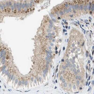 Immunohistochemistry-Paraffin: SLC38A10 Antibody [NBP1-81194]