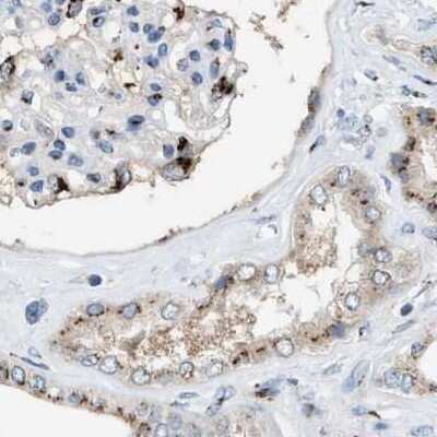 Immunohistochemistry-Paraffin: SLC38A10 Antibody [NBP1-81194]