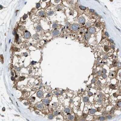 Immunohistochemistry-Paraffin: SLC38A10 Antibody [NBP1-81194]