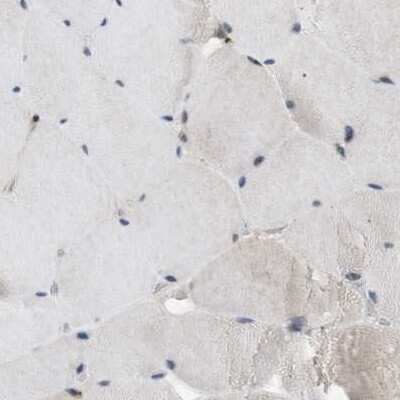 Immunohistochemistry-Paraffin: SLC38A10 Antibody [NBP1-81194]