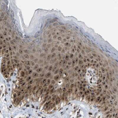 Immunohistochemistry-Paraffin: SLC38A10 Antibody [NBP1-81194]