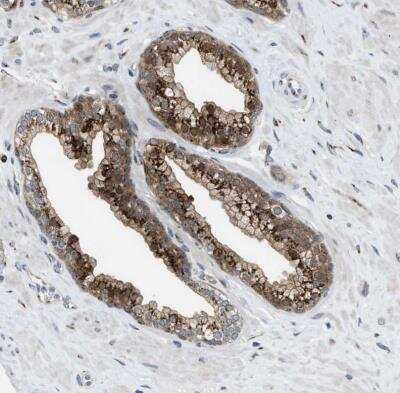 Immunohistochemistry-Paraffin: SLC38A10 Antibody [NBP1-81194]