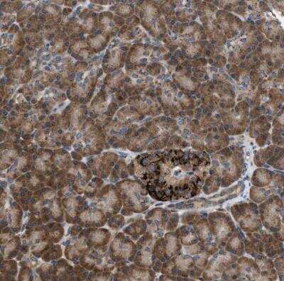 Immunohistochemistry-Paraffin: SLC38A10 Antibody [NBP1-81194]