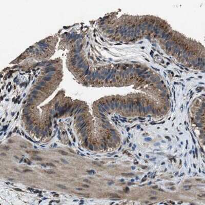 Immunohistochemistry-Paraffin: SLC38A10 Antibody [NBP1-81195]