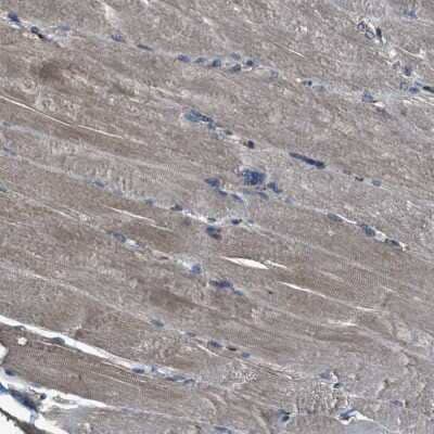 Immunohistochemistry-Paraffin: SLC38A10 Antibody [NBP1-81195]