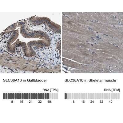 Immunohistochemistry-Paraffin: SLC38A10 Antibody [NBP1-81195]