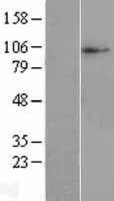 Western Blot: SLC38A10 Overexpression Lysate [NBL1-16136]