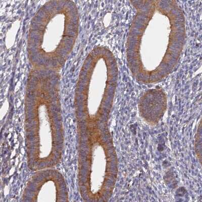 Immunohistochemistry-Paraffin: SLC38A11 Antibody [NBP1-88918]